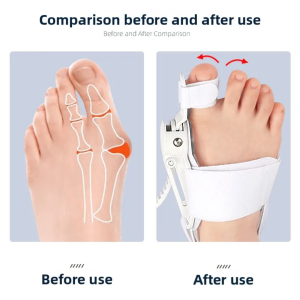 orthèse de valgus réglable
